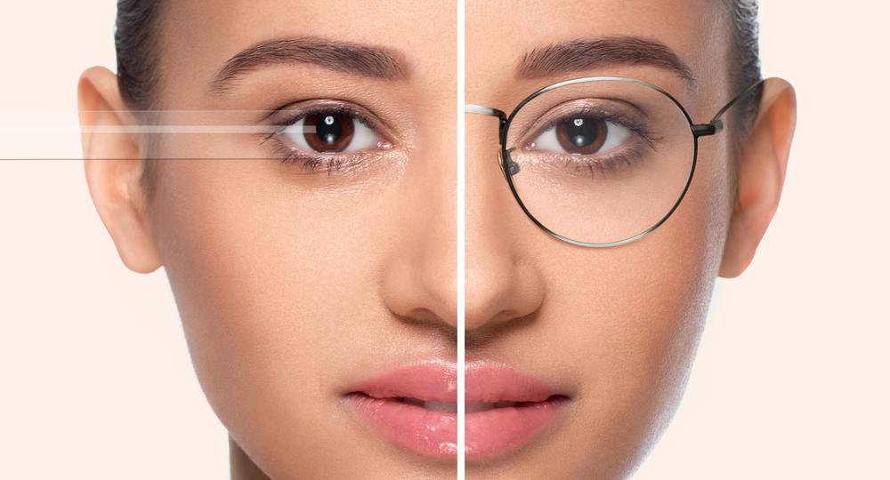 Laser vision correction